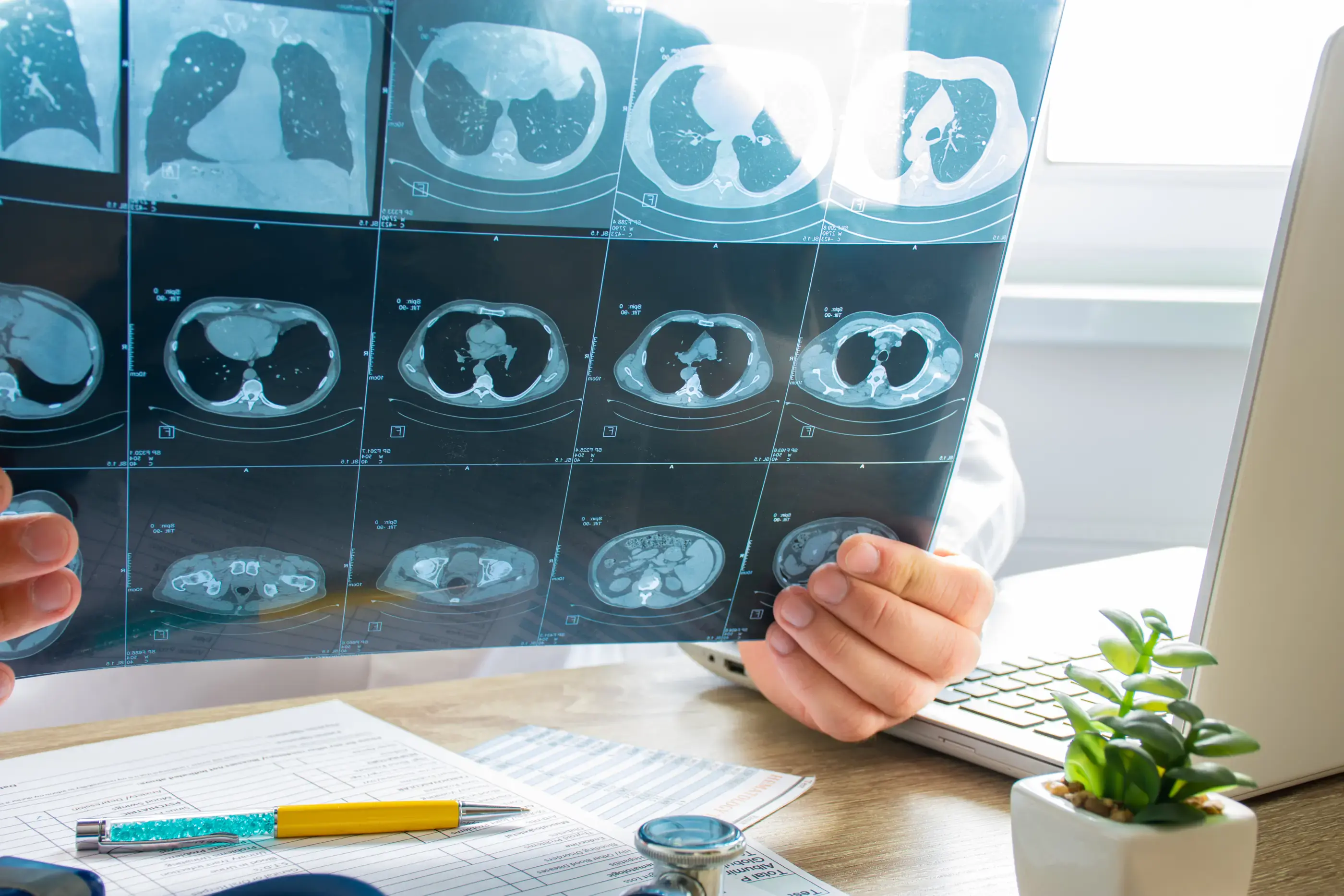 A doctor examining a chest CT scan.